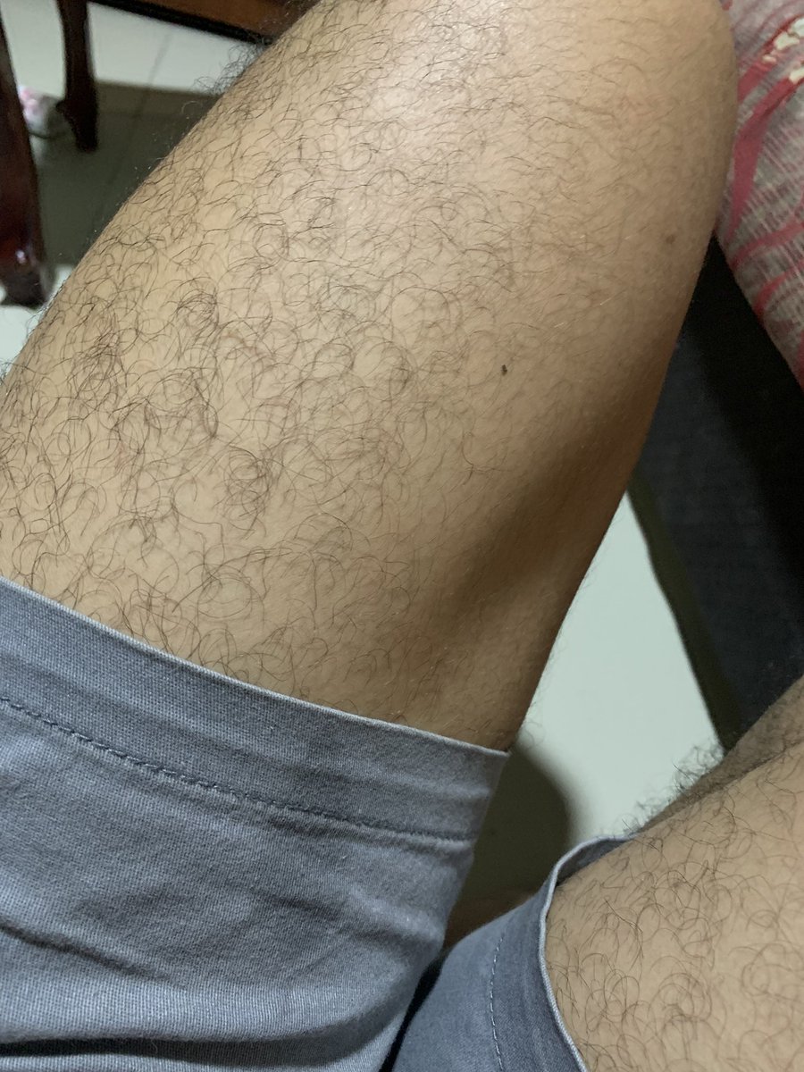 colleenketh's tweet photo. who loves hairy legs? https://t.co/3o8DCAT8wK