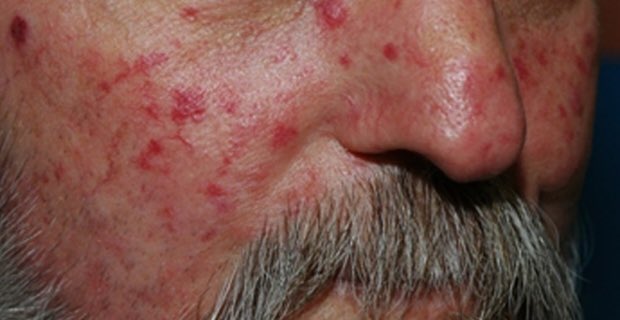 BrownJHM's tweet image. Patient presented with difficulty swallowing &amp;amp; abdominal pain. Diagnosis? (Images: Medbullets, Radiopaedia.com, Yair Glick) #medtwitter