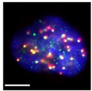 IGBMC (@igbmc) on Twitter photo 👩🔬👏 <a href="/SumaraLab/">Izabela Sumara</a> with <a href="/EvaPangou/">Eva Pangou</a> as lead scientist identified the ubiquitin-binding factor UBAP2L as a novel regulator of PLK1, an essential #kinase preserving #genome stability and #cell survival throughout mitosis.
📕 <a href="/emboreports/">EMBO Reports</a>
📰bit.ly/3I04r9P 👩🔬👏 <a href="/SumaraLab/">Izabela Sumara</a> with <a href="/EvaPangou/">Eva Pangou</a> as lead scientist identified the ubiquitin-binding factor UBAP2L as a novel regulator of PLK1, an essential #kinase preserving #genome stability and #cell survival throughout mitosis.
📕 <a href="/emboreports/">EMBO Reports</a>
📰bit.ly/3I04r9P
