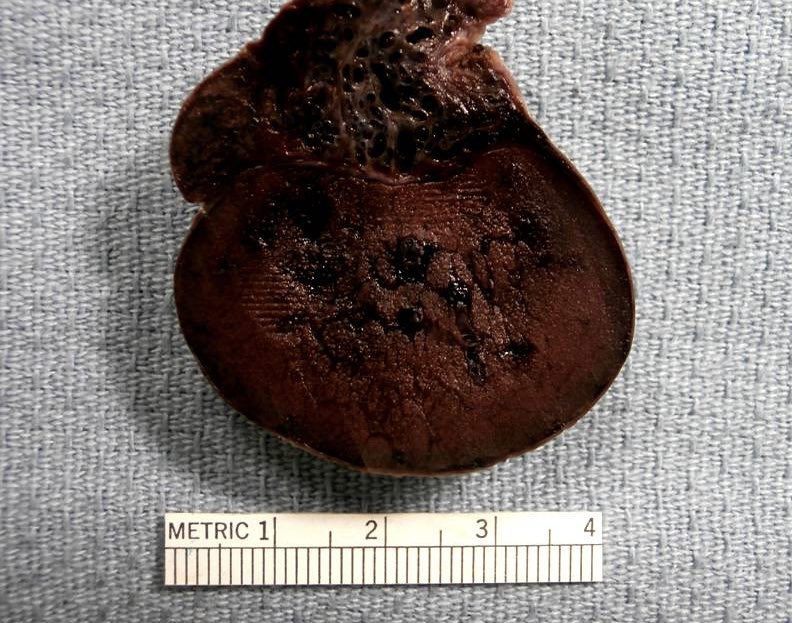 лиса с пинцетом Шора on Twitter: "перекрут яичка - это его поворот из ...