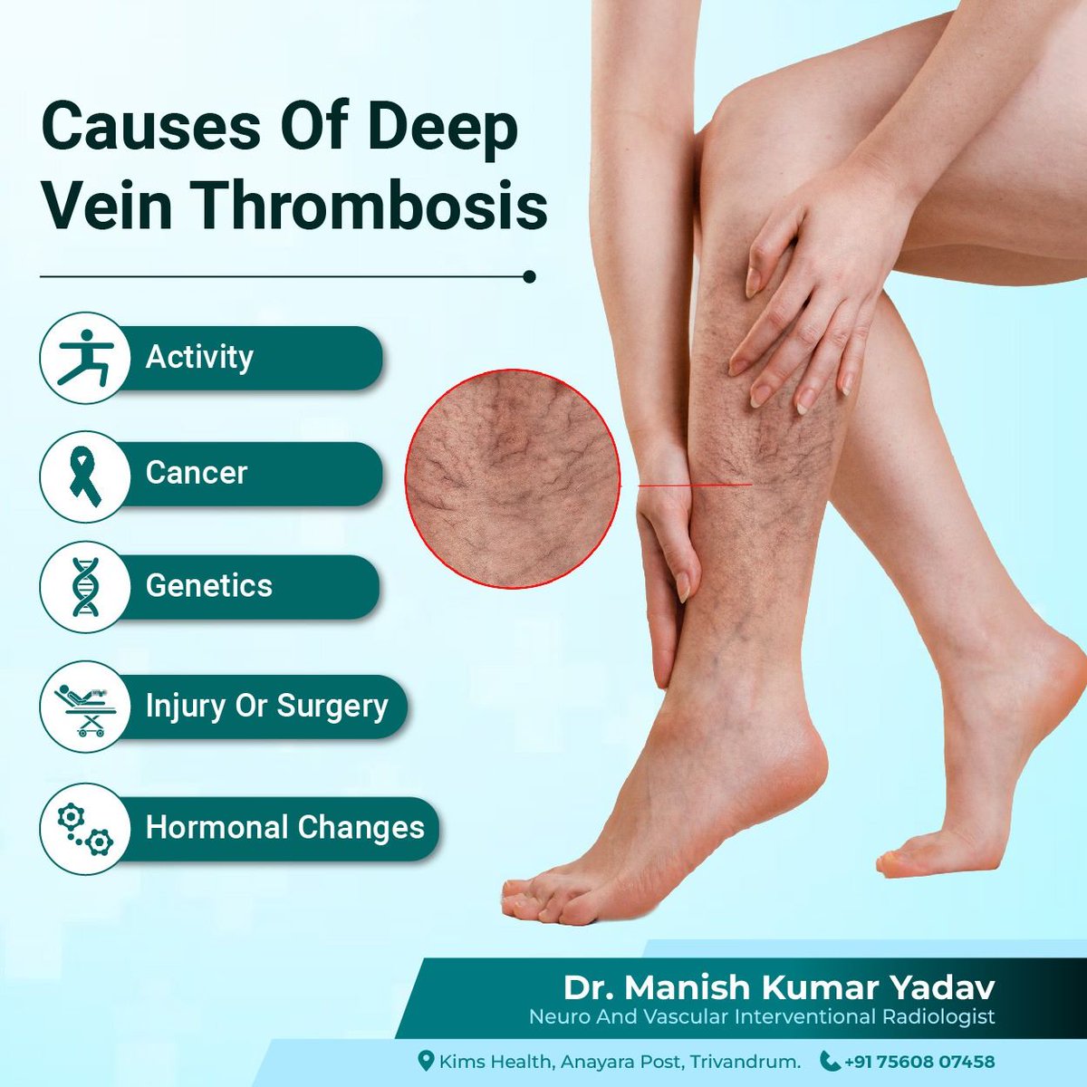 Symptoms of #DVT: swelling, pain, warmth, & redness in affected leg. If left untreated, it can cause serious complications like pulmonary embolism. Learn more from #DrManishKumarYadav. 

Call +91 75608 07458. 

#vascularhealth #bloodclotprevention #veinhealth