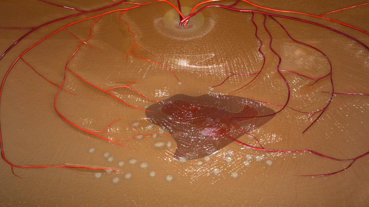 eyetechoptom's tweet photo. https://t.co/1f2StBjU28 https://t.co/Tfms1g2vck Controversies in Modern Eye Care 2023: Early detection of age ... - Optometry Times https://t.co/goBUjgioEv