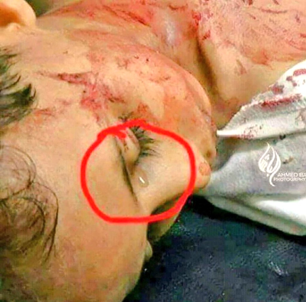 derradjihafid's tweet photo. فتاة فلسطينية عمرها عشر سنوات استشهدت والدمعة تنزل من عينها،  ليس خوفا أو جبنا ، بل حبا في طنها ، و حسرة وألما على من خذلها وخان شعبها .
لا حول ولا قوة الا بالله https://t.co/XTCcZKWyDV