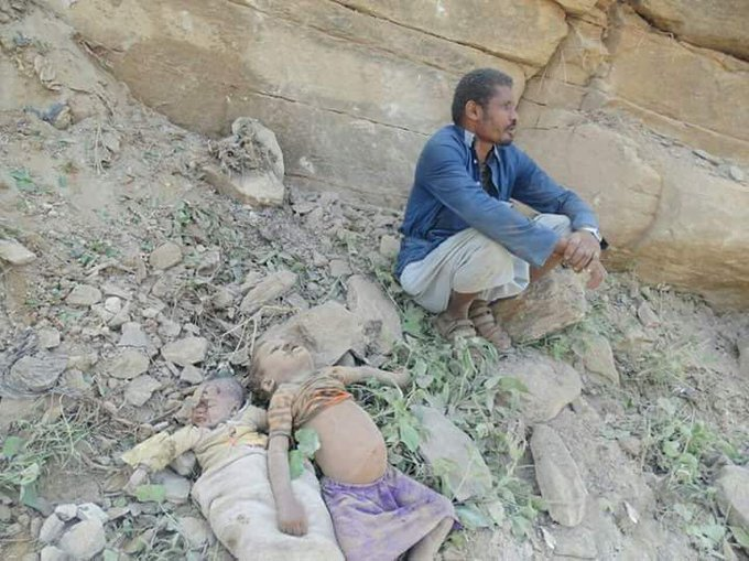 SoftWarNews's tweet photo. Adegan yang sangat menyayat hati 

Patah hati seorang pria Yaman terhadap anak-anaknya dan mayat mereka di sisinya, duduk di atas puing-puing rumahnya, yang menjadi sasaran serangan udara Saudi-Emirat.

Kejahatan Perang yang Tak Pernah Dikecam https://t.co/hckzZ32oZB