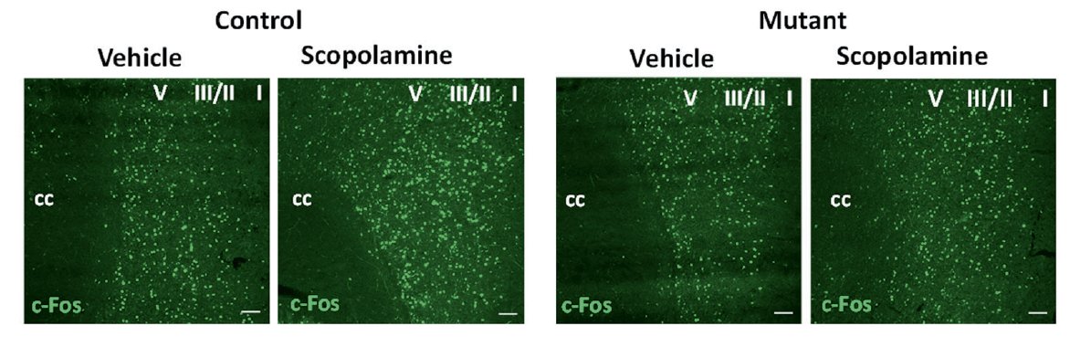 npp_journal's tweet photo. New and online in @npp_journal "M1 acetylcholine receptors in somatostatin interneurons contribute to GABAergic and glutamatergic plasticity in the mPFC and antidepressant-like responses" led by Manoela Fogaca @MarinaP63
https://t.co/3mSMj17w5S https://t.co/yQnCBJSNwF
