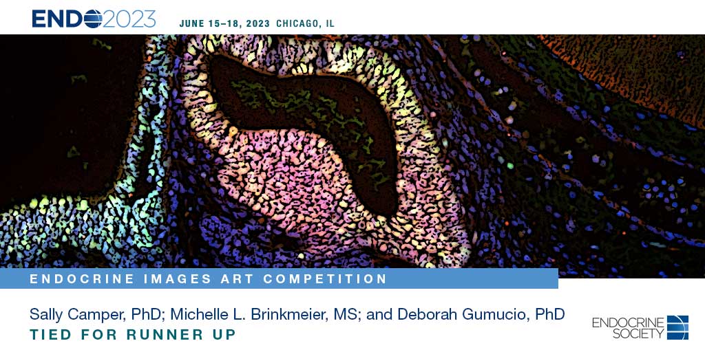 This image of the #pituitary slice from a mouse embryo submitted by <a href="/sallycamper/">scamper</a>, <a href="/grannyfossil/">Deb Gumucio</a>, and Michelle Brinkmeier tied for second place! View their image at #ENDO2023 and explore pituitary related sessions (bit.ly/3WPG5o3 ). <a href="/UM_Genetics/">Michigan Genetics</a> <a href="/BioArtography/">BioArtography</a>