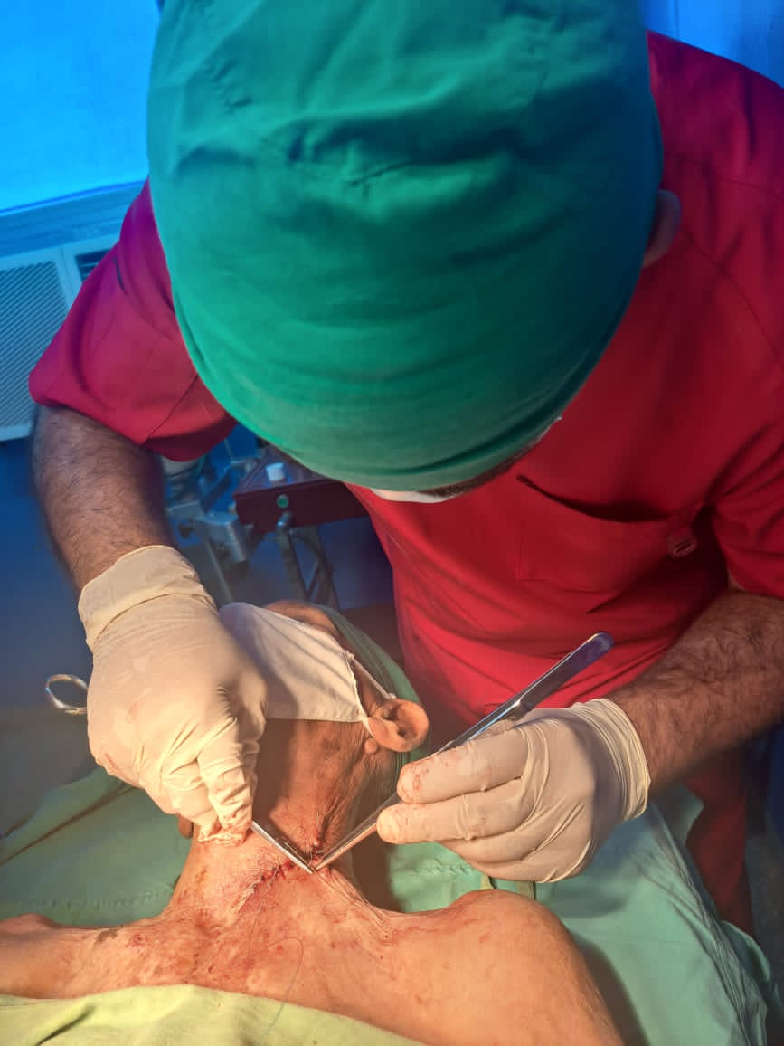 Salón de Cirugía Menor  Especialidad Dermatología. Exceresis de tumor periférico(Carcinoma Epidermoide)localizado en región lateral del cuello. <a href="/DPSHabana/">Dirección General de Salud La Habana</a>