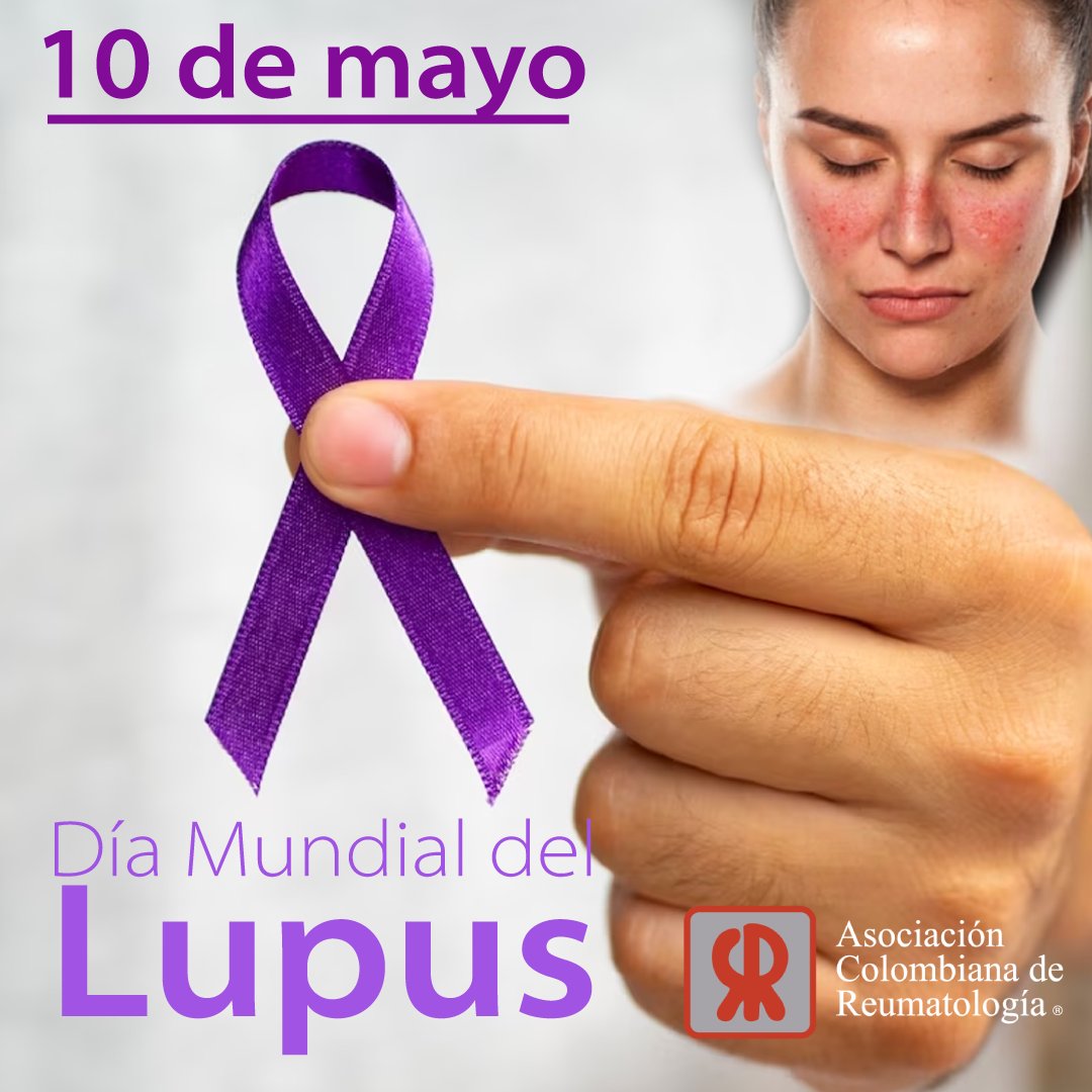 Hoy conmemoramos el día mundial del lupus.🦋

🔎 El lupus eritematoso sistémico es una enfermedad que se presenta cuando el sistema inmune ataca los propios tejidos y órganos (enfermedad autoinmune), alterando su funcionamiento e integridad....