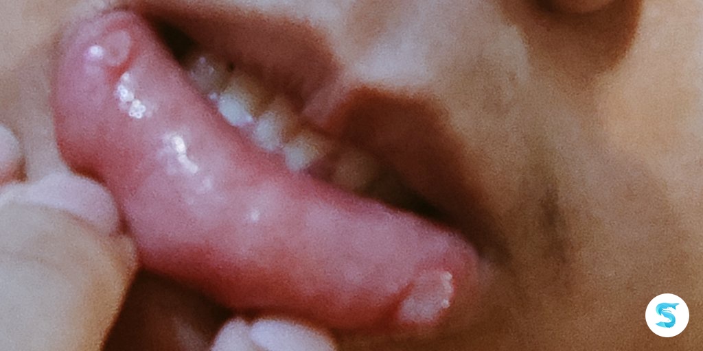 🦈 SUROBOYOFESS 🐊 tweet media