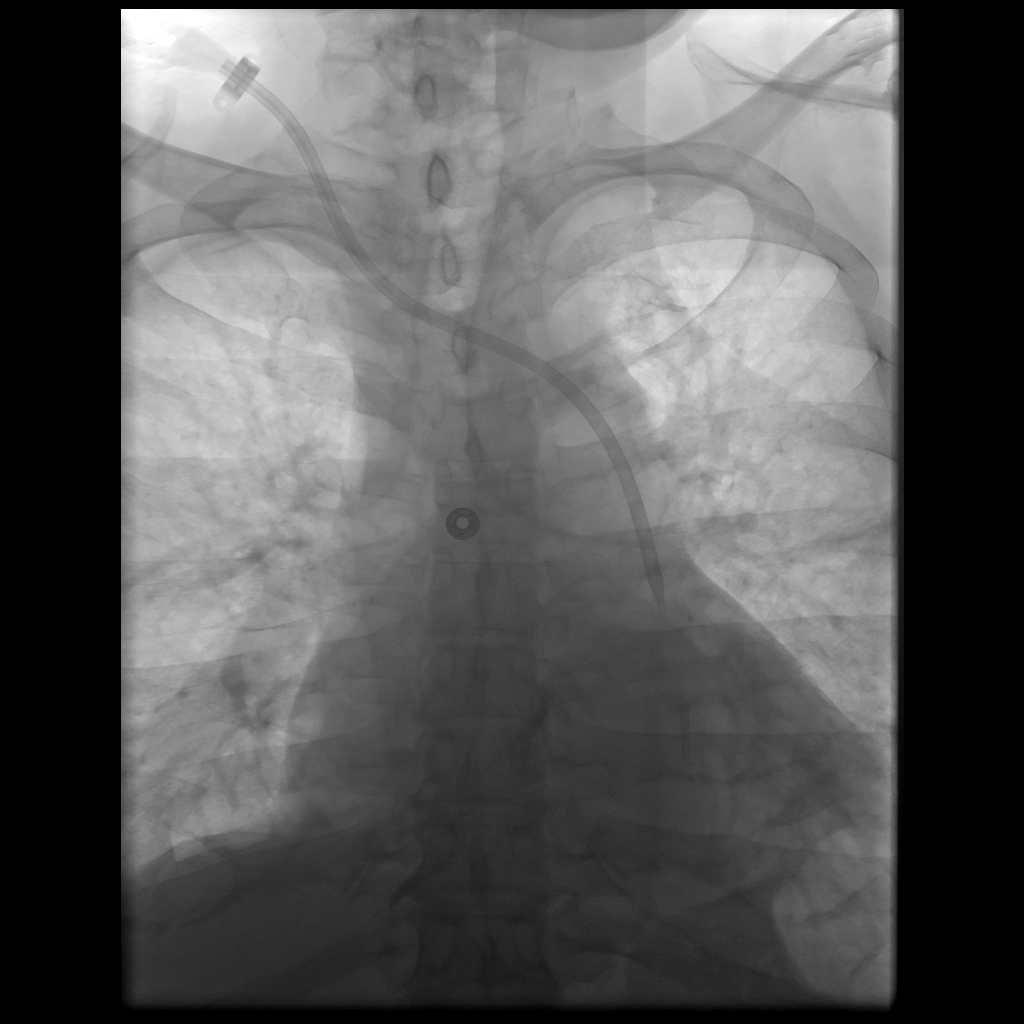 Peder E. Horner, MD Interventional Physician tweet media