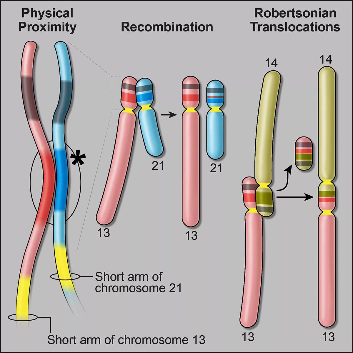 My favorite T2T/Pangenome discovery so far: a multi-megabase inverted segmental duplication on the short arm of chr14 that explains the mechanism of Robertsonian translocations. Great writeup by @ScienceStowers 'Answering a 50-year-old mystery' stowers.org/news/investiga…