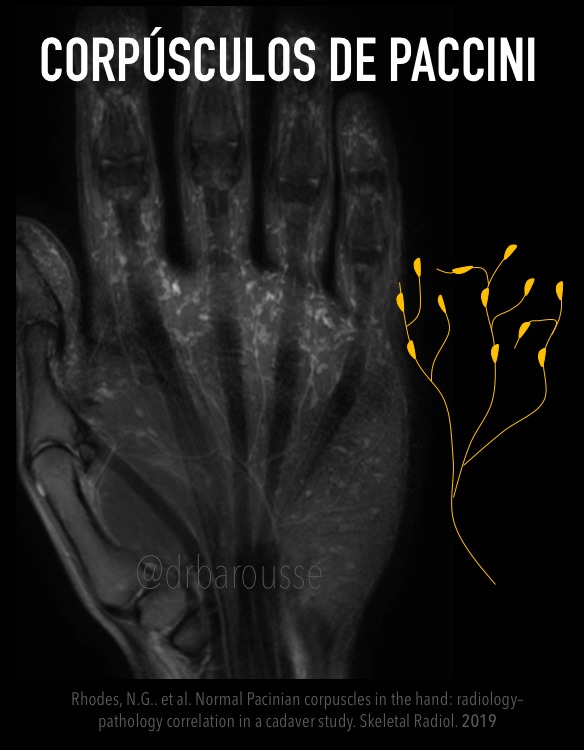 drbarousse's tweet photo. I know that you saw this image many times and hesitated to put something in your report. They are normal, hypertrophied sensory nerve structures.#nerve #msk #MRI https://t.co/Tr3jOV77CA