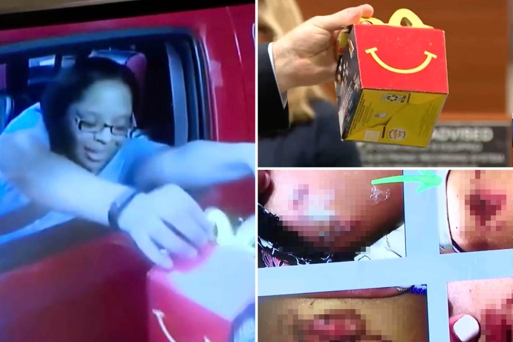 nypost's tweet photo. Florida parents sue McDonald’s after ‘dangerously hot’ McNugget left their daughter, 4, with second-degree burns https://t.co/3JnKLV99mh https://t.co/1tGf3J7reY