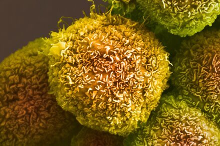 "Pancreatic Cancer Vaccine Shows Promise in Small Trial" via NYT ift.tt/ORcy7of