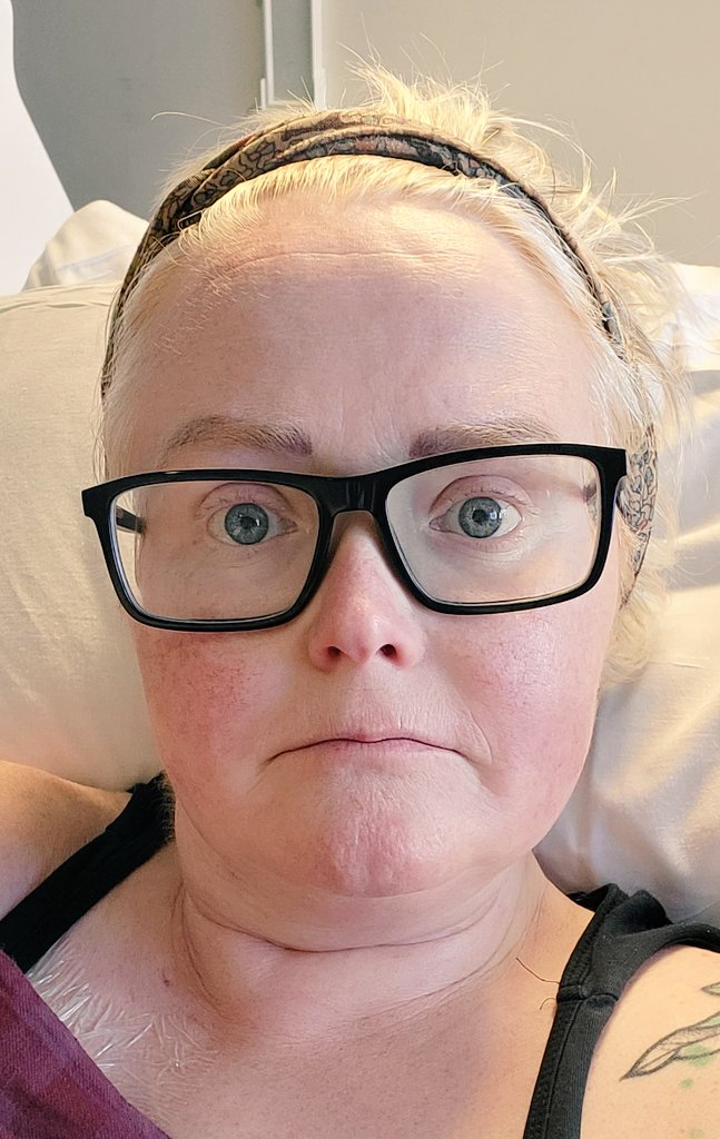 Celine Garvey on Twitter "My face looks really flat since chemo It's