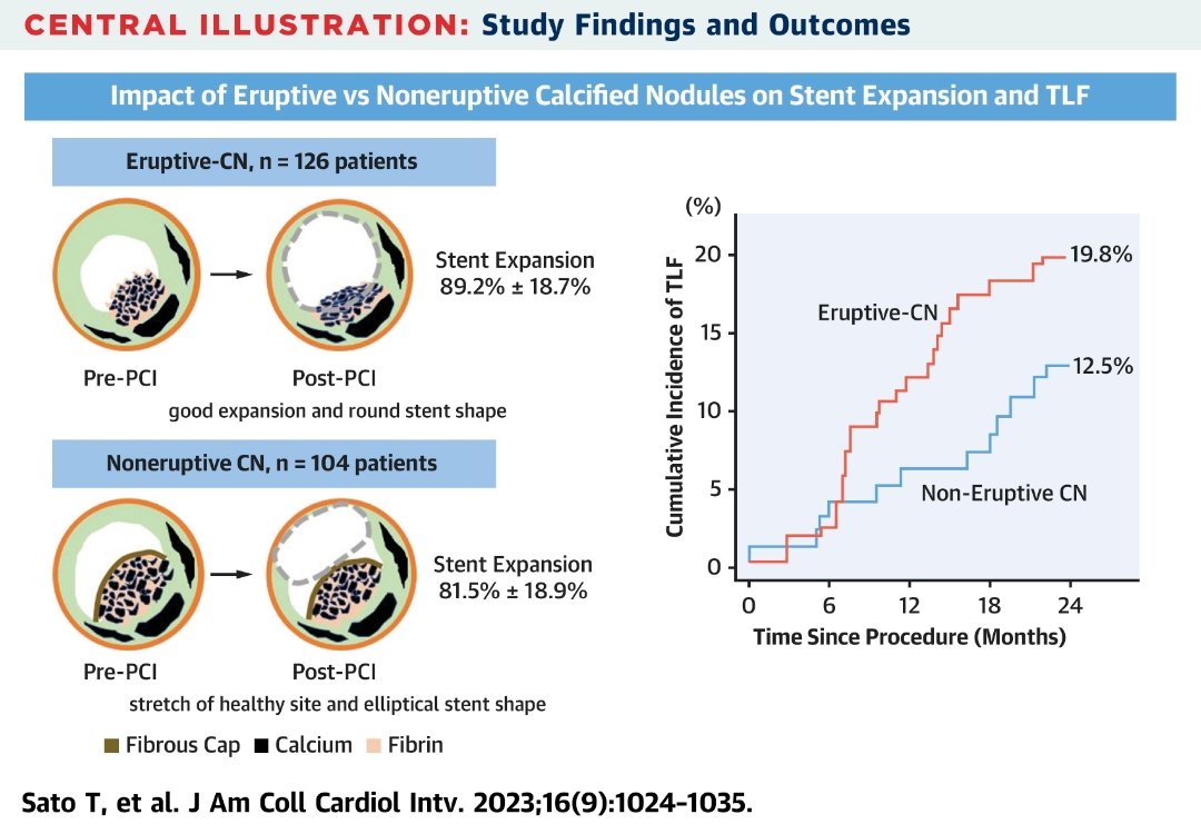 Syed Ali Naqvi (@syedynaqvi1) on Twitter photo Nice study. Eruptive calcified nodule has worse TLF at 2 years than non-eruptive calcified nodule. "The calcified nodule paradox" is the title of the editorial!
From <a href="/jaccjournals/">JACC Journals</a> jacc.org/doi/10.1016/j.… Nice study. Eruptive calcified nodule has worse TLF at 2 years than non-eruptive calcified nodule. "The calcified nodule paradox" is the title of the editorial!
From <a href="/jaccjournals/">JACC Journals</a> jacc.org/doi/10.1016/j.…