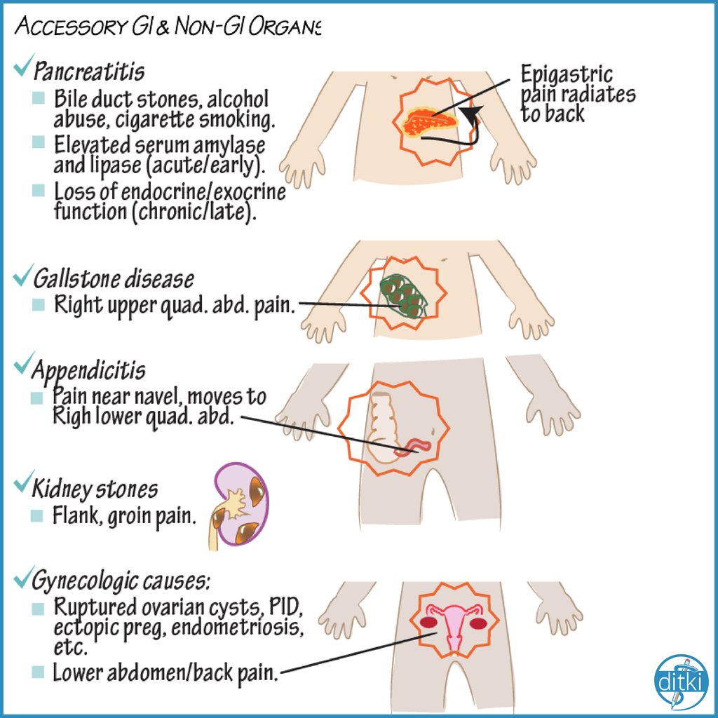 #ditki #usmle #meded #medschool #medstudent #highered #usmletutorials #GIpain #pancreatitis #gallstones #appendicitis #kidneystones #ovariancysts #PID #nursing #pance #physicianassistant #medicine #science #nurse #premed #mbbs