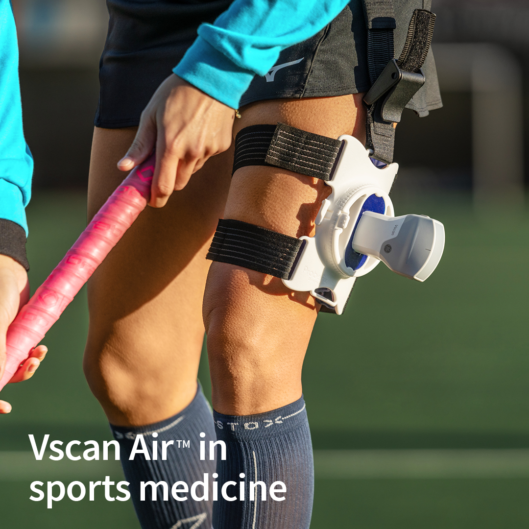 jrobi09's tweet photo. Together with @usono we're changing the game: @vscanwith ProbeFix Dynamic for live scanning of muscles in motion, directly on the pitch! #dynamicscanning #gehealthcareultrasound #sportsmedicine #vscanair #usono #probefix #musclesinmotion #rethinkultrasound #POCUS https://t.co/w6pGpQhd33