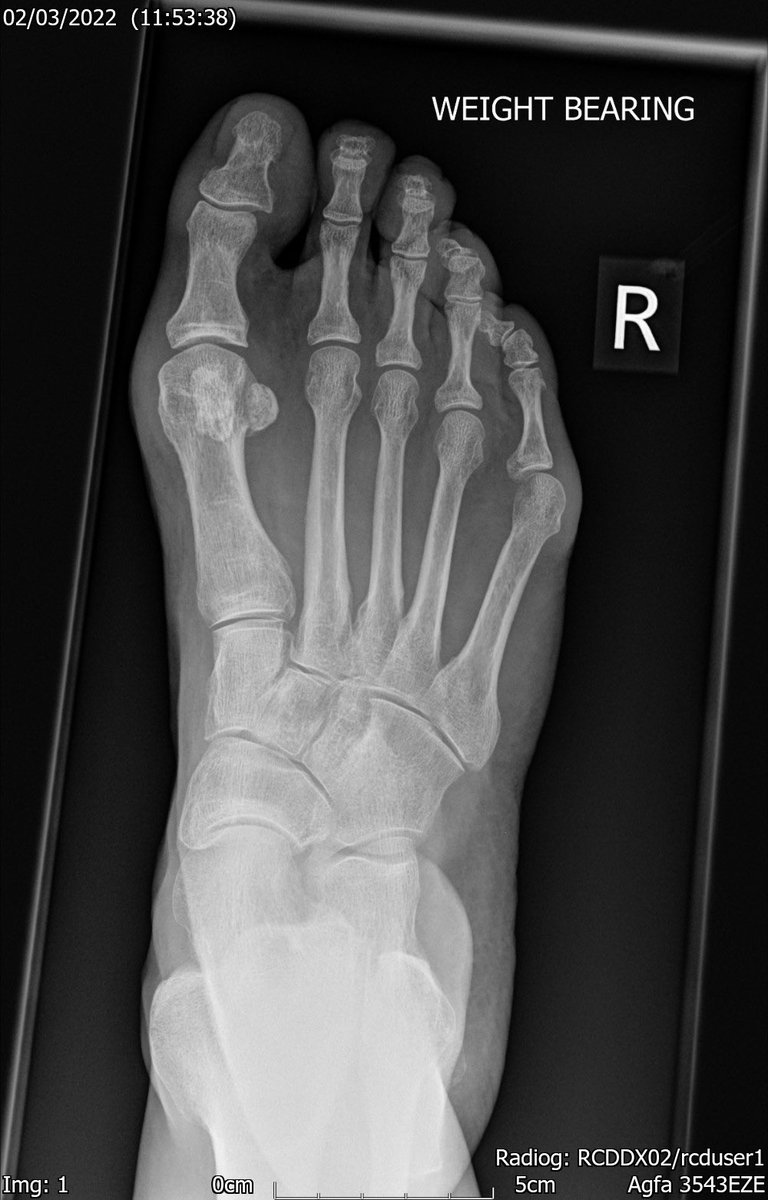 Yorkshire F&A Clinic @feet2knees tweet media