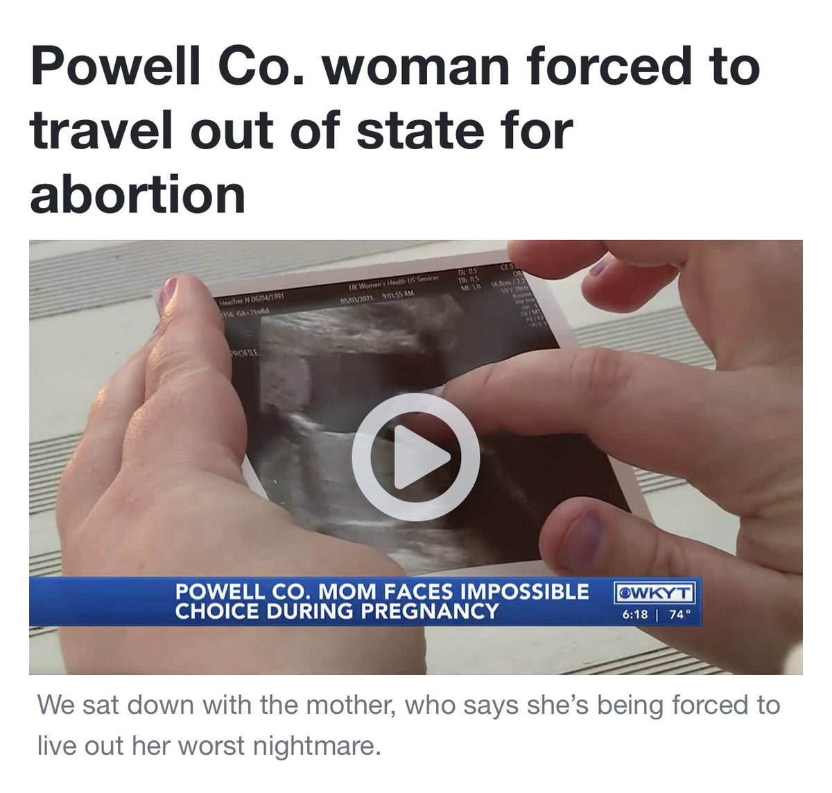 A woman in Kentucky was told her fetus had a fatal abnormality known as anencephaly. Doctors in Kentucky were unable to terminate her pregnancy due to the state’s abortio ban.

Her options? Travel out of state or continue the doomed pregnancy for months. The cruelty is the point.