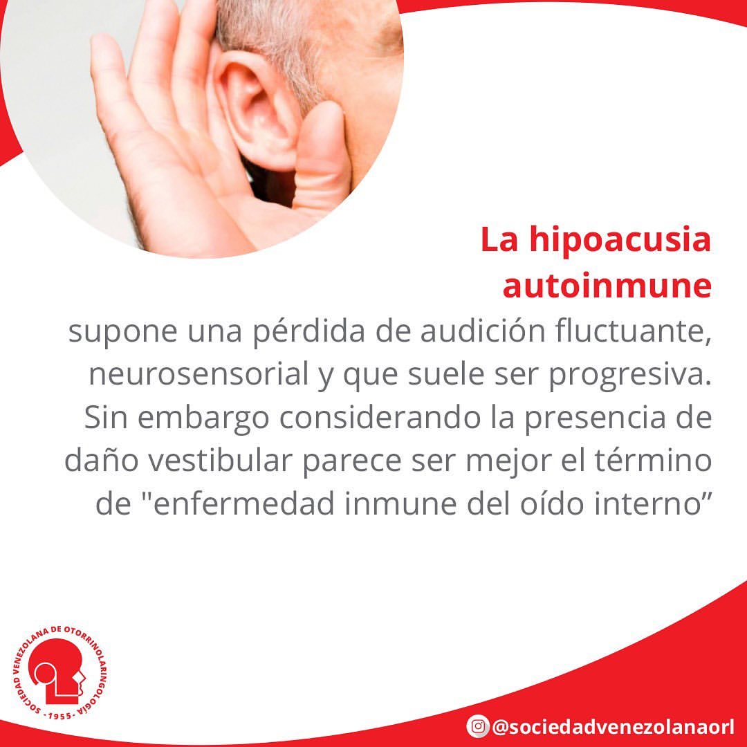 svorl's tweet photo. El Lupus Eritematoso Sistémico (LES) tiene una amplia variedad de manifestaciones clínicas, entre ellas la hipoacusia (pérdida auditiva) y síntomas vestibulares ( vértigo y tinnitus), por ello el control por el otorrino es fundamental #DiaMundialDelLupus #SVORL https://t.co/ZuMoOFghHu
