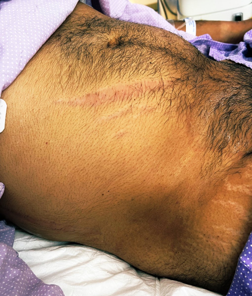 OrlandoRPN's tweet image. Síndrome de…