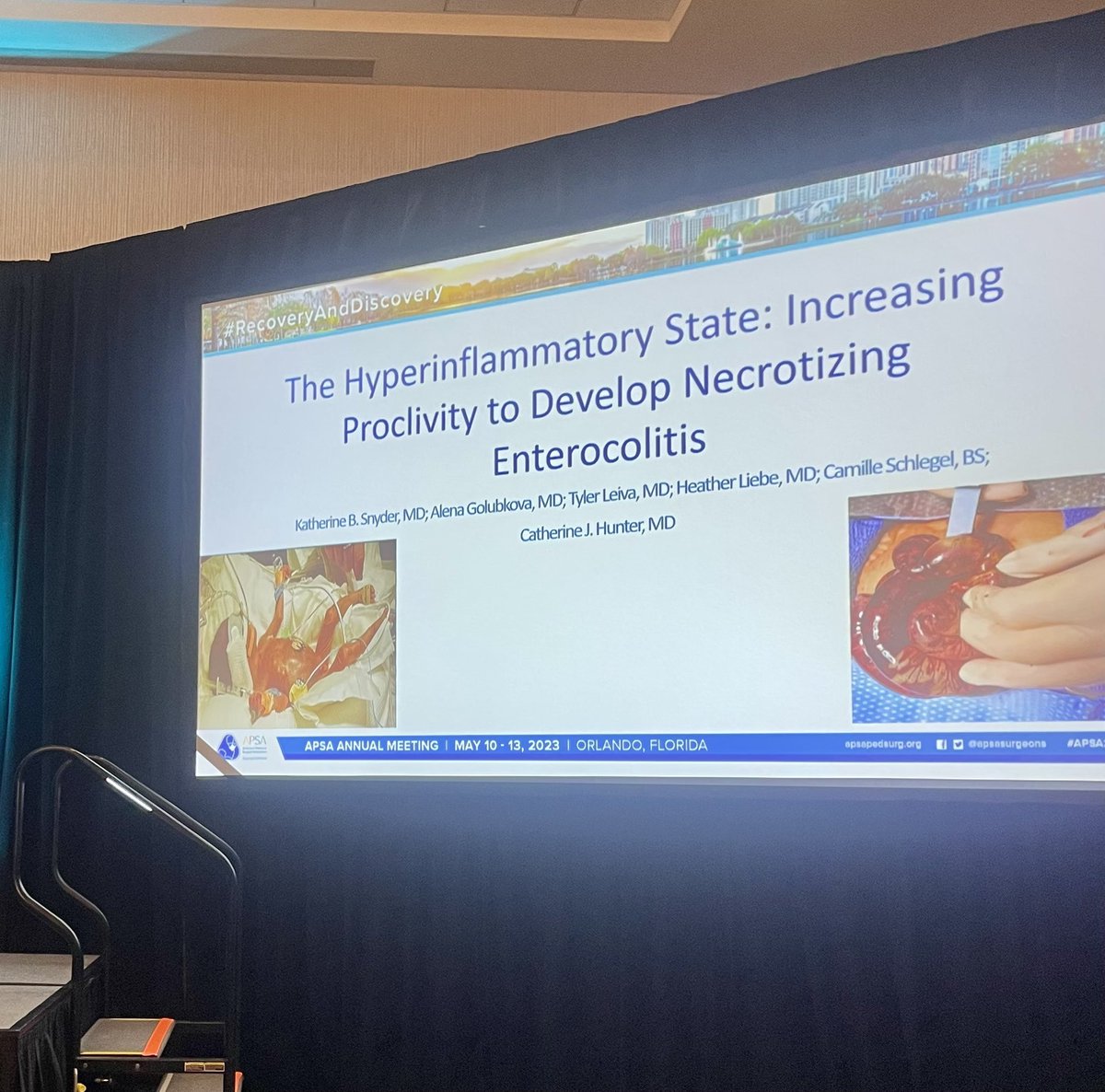 Tyler Leiva (@tylerdleiva) on Twitter photo As always, <a href="/kbsnyder9/">Brooke Snyder</a> gave a great presentation on persistent inflammatory states even after NEC recovery! Great work! #APSA2023 #hunterlab #proclivity <a href="/OU_Surgery/">OU Surgery</a> <a href="/OUPedSurg/">OU Children’s Ped Surg Fellowship</a> As always, <a href="/kbsnyder9/">Brooke Snyder</a> gave a great presentation on persistent inflammatory states even after NEC recovery! Great work! #APSA2023 #hunterlab #proclivity <a href="/OU_Surgery/">OU Surgery</a> <a href="/OUPedSurg/">OU Children’s Ped Surg Fellowship</a>
