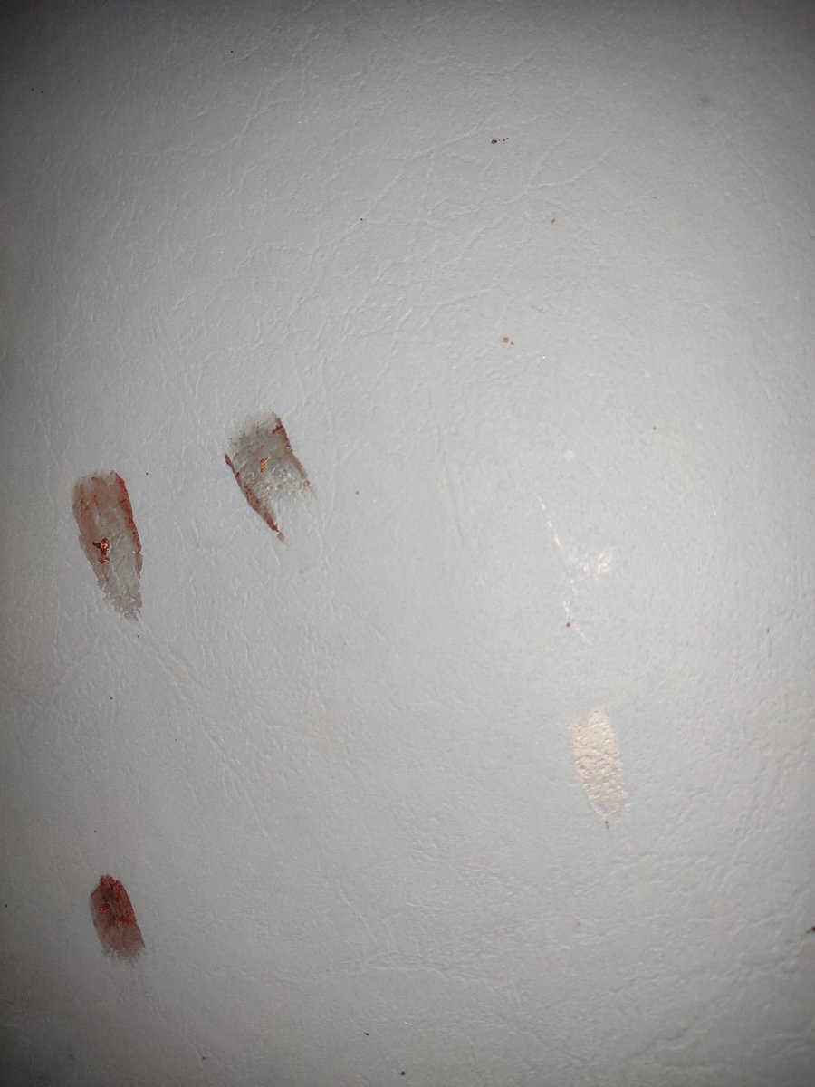 ash_kothavade's tweet photo. @RailMadad See the bedbugs i have killed .. i strongly demand for a strict action against cleaning and pest controlling team. https://t.co/q9qQmuswHJ