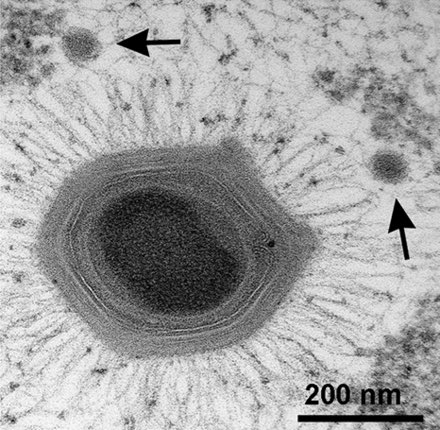 #VirusOfTheDay 14

Mimiviridae

Acanthamoeba polyphaga mimivirus is the only member of the family mimiviridae. Its structure is unique due to its massive diameter and it can even be gram-stained! It’s known as the “mimicking microbe” and was originally thought to be a bacterium.