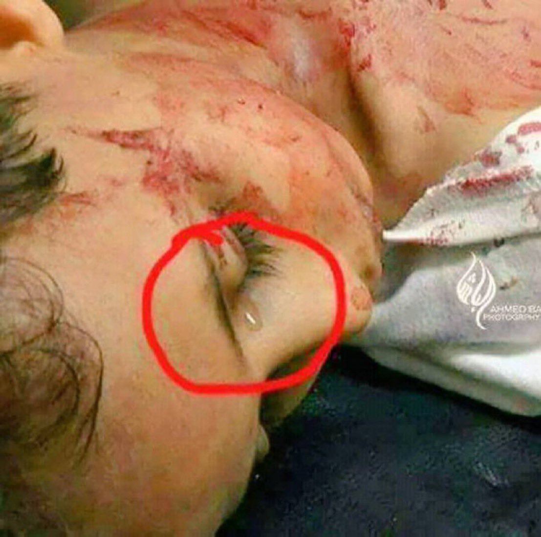 لا كلام ابلغ من هذه الدمعة التي قالت كل شيء .. 
،،،، إِلى ديان يوم الدين نمضي
وعند الله تجتمع الخصوم

#غزة_تحت_القصف