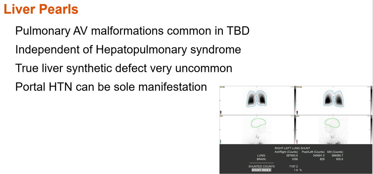 🌟#MayoMGR today with @MrinalPatnaik :
'Telomere Biology Disorders – From Bench to Bedside'
@TeamTelomereInc @MayoClinicCIM @MayoClinicGIHep @MayoPCCM @Dr_Vijay_Shah 
#Telomere #TelomereBiologyDisorders #PrecisionMedicine #PulmTwitter #LiverTwitter #HemeTwitter #MedTwitter