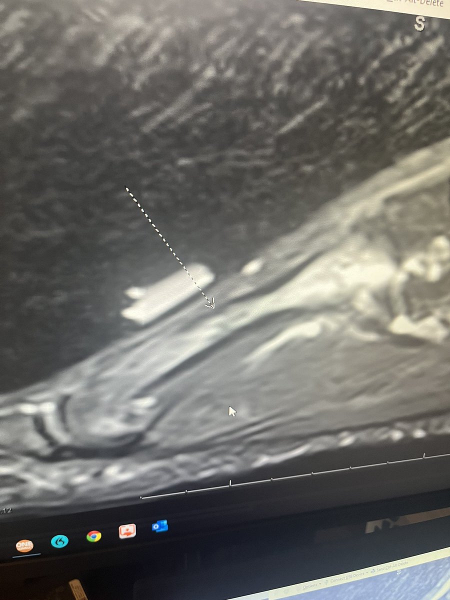 Ryan Benamar tweet media