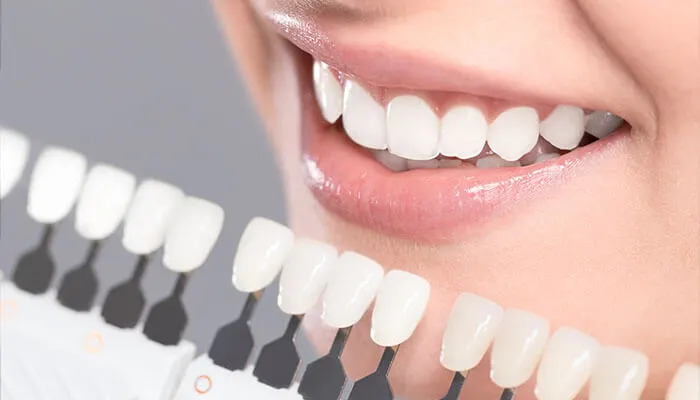 Pros And Cons Of Dental Crowns:

tycoonstory.com/pros-and-cons-…

@dentakay #dentistry #toothdecay #dentalcrowns #dentalimplants #goldcrowns #dentalcap #dentaltreatments #toothcare #toothsensitivity #dentalhealth #jawpain #porcelain