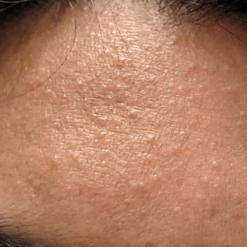 secretlyfura's tweet photo. If you have this, use this 👍🏻

Been using these two by La Roche Posay for quite some time now. Barely even recognize my skin, tiny bumps hilang, no more textured skin tinggal nak focus on hilangkan pigmentation je 😭💗 https://t.co/J0jsBHuARE