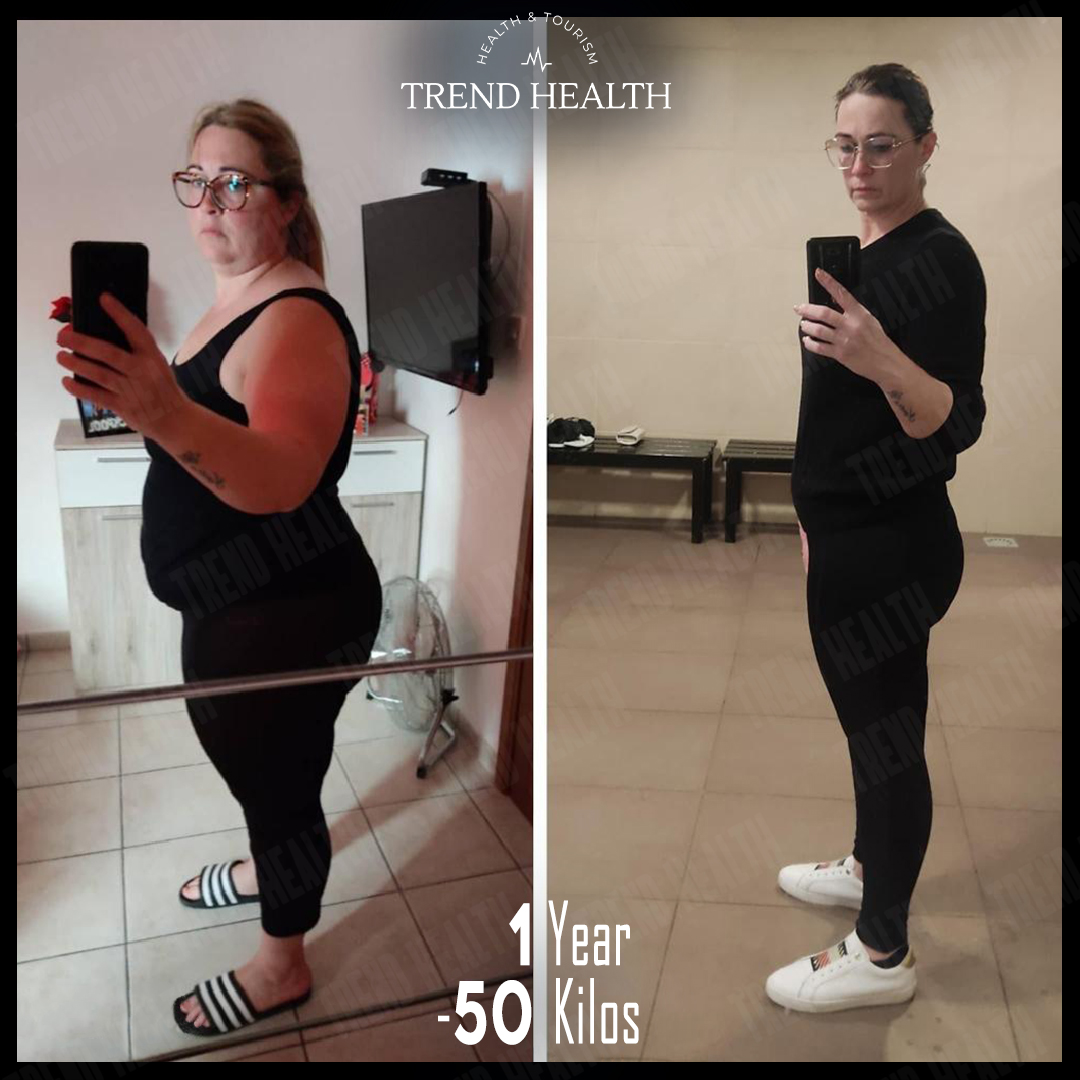 TrendHealthtr's tweet photo. Joanne ❤️
#beforeandafter #beforafterweightloss #sleevegastrectomy #sleevesurgery #obesitysurgery #weightlossjourney #weightlosstransformation #gastricsleeve #gastricbypass #weightlossurgery #trendhealth #healthtourismturkey #healthtourisminturkey #healthtourism https://t.co/gynVVAZZx4