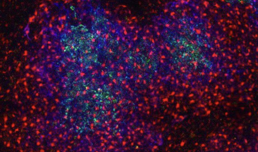 Tolar Lab (@tolarlab) on Twitter photo Interested in working on the germinal centre? We still have two postdoc positions available. Please get in touch or apply here:
ucl.ac.uk/work-at-ucl/se… Interested in working on the germinal centre? We still have two postdoc positions available. Please get in touch or apply here:
ucl.ac.uk/work-at-ucl/se…