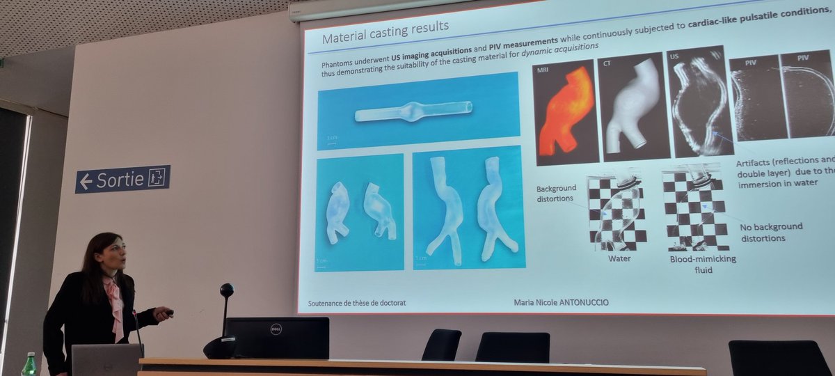 CPH Vascular Research Unit (@vascularcph) on Twitter photo Exciting PhD defence on argued ultrasound of AAA. Very talented graduate, Maria Nicole Antonuccio, from an impressive team here at Mines in Saint-Etienne, France. <a href="/VascularCph/">CPH Vascular Research Unit</a> <a href="/EibergJonas/">Jonas Eiberg</a> Exciting PhD defence on argued ultrasound of AAA. Very talented graduate, Maria Nicole Antonuccio, from an impressive team here at Mines in Saint-Etienne, France. <a href="/VascularCph/">CPH Vascular Research Unit</a> <a href="/EibergJonas/">Jonas Eiberg</a>
