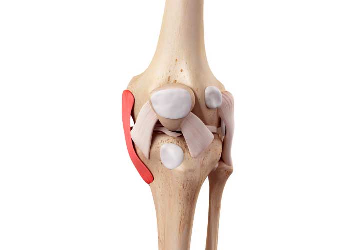 drprovencher's tweet photo. Knee Fact of the Day!
Even though patients are more familiar w/an #ACLinjury, MCL injuries account for approximately 24% of all knee injuries. When the #MCL sustains damage during a fall or sports injury, patients will experience...https://t.co/D1bbadv1VS #MCL #MCLreconstruction https://t.co/8Xht94ti2H