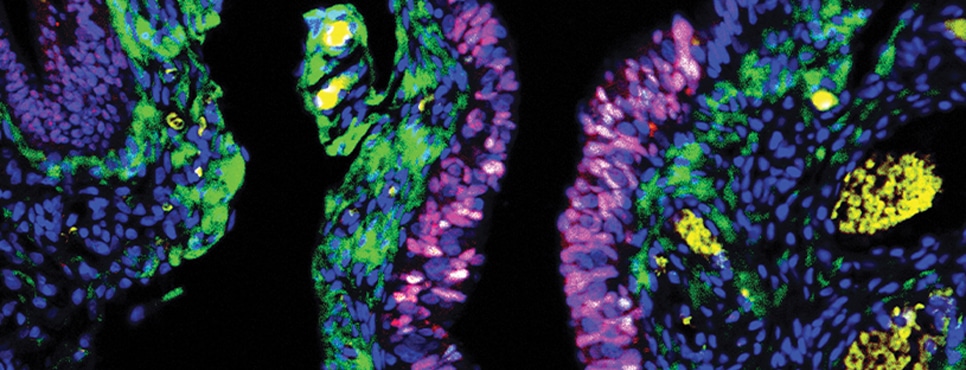 AACR (@aacr) on Twitter photo Submit an abstract by July 18 for the AACR Special Conference on Ovarian Cancer (October 5-7, Boston), chaired by <a href="/FrancesBalkwill/">Frances Balkwill</a>, <a href="/DrBenNeel/">Benjamin Neel</a>, <a href="/KunleOdunsiMD/">Kunle Odunsi, MD</a>, and <a href="/SwisherLiz/">liz swisher</a>. Learn more:
bit.ly/3OFZBmm
#AACRovc23 <a href="/SwisherLab/">Swisher Lab</a> Submit an abstract by July 18 for the AACR Special Conference on Ovarian Cancer (October 5-7, Boston), chaired by <a href="/FrancesBalkwill/">Frances Balkwill</a>, <a href="/DrBenNeel/">Benjamin Neel</a>, <a href="/KunleOdunsiMD/">Kunle Odunsi, MD</a>, and <a href="/SwisherLiz/">liz swisher</a>. Learn more:
bit.ly/3OFZBmm
#AACRovc23 <a href="/SwisherLab/">Swisher Lab</a>