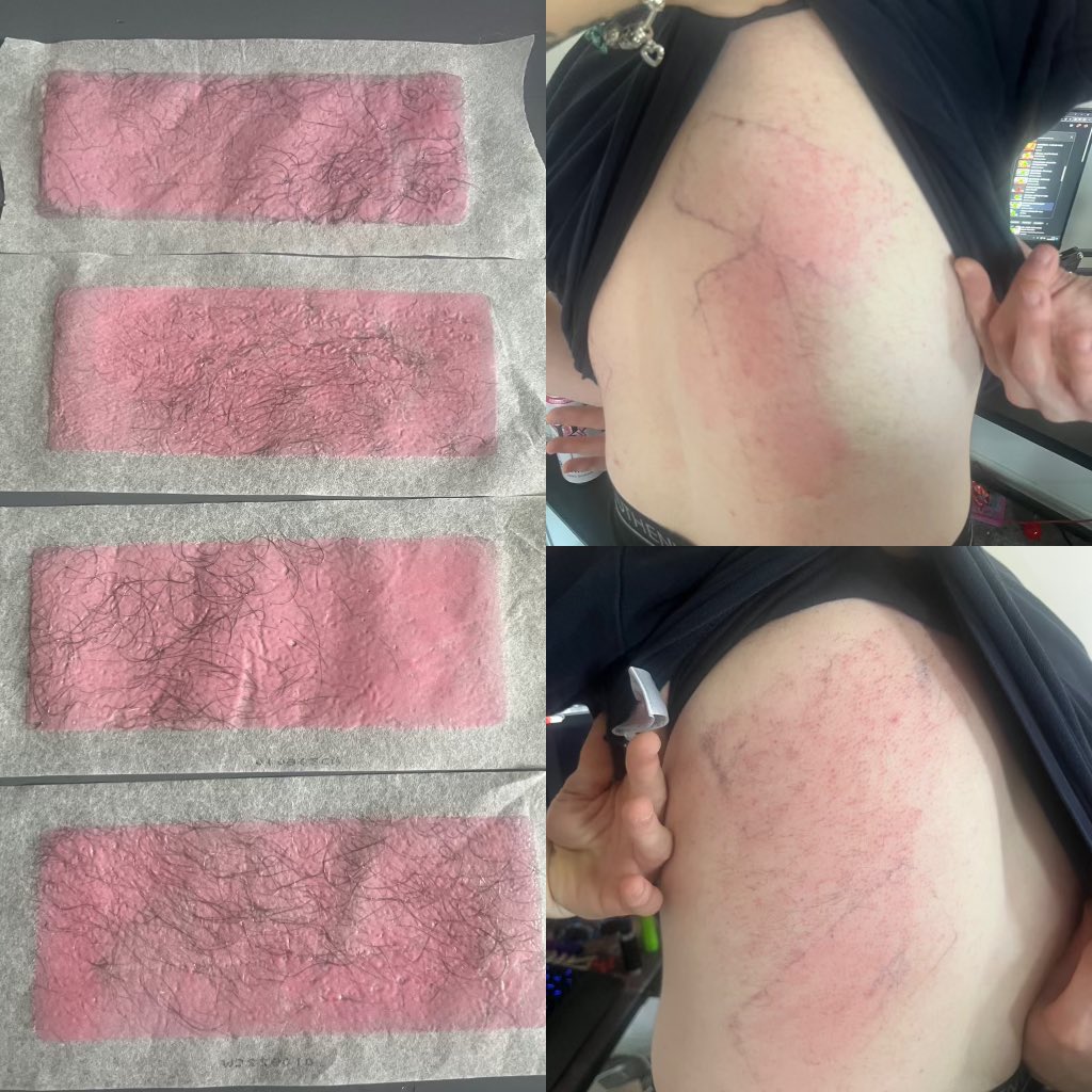 WarbOnKick's tweet photo. So the subs started coming in and I appreciate all of you guys but the result was to get my back waxed 😢🙄😂
@kick @ItsMeBadbunny @Giriiss @official_gio12
https://t.co/01xaIbIiXG 4.5 hours left of stream 🫡🫡🫡💚
#Content #kickstream #KickStreamer #KickArmy #backwax https://t.co/OCf5XKD9Cd