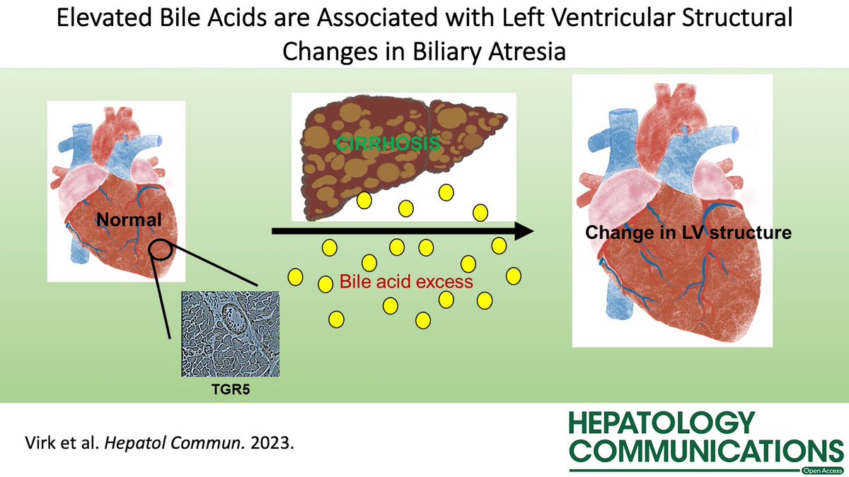 ⬆️#BileAcids are associated w 🫀LV remodeling in children with biliary atresia!

Highlights a unique role for bile acids not only as biomarkers, but as one potential causative trigger for LV remodeling.  
#BiliaryAtresia #LiverTwitter #OpenAccess

journals.lww.com/hepcomm/Fullte…