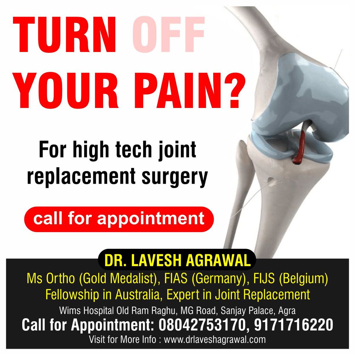 Joint replacement surgery in Agra
Joint replacement surgery is a pro ..For more info visit...drlaveshagrawal.com/latest-update/…