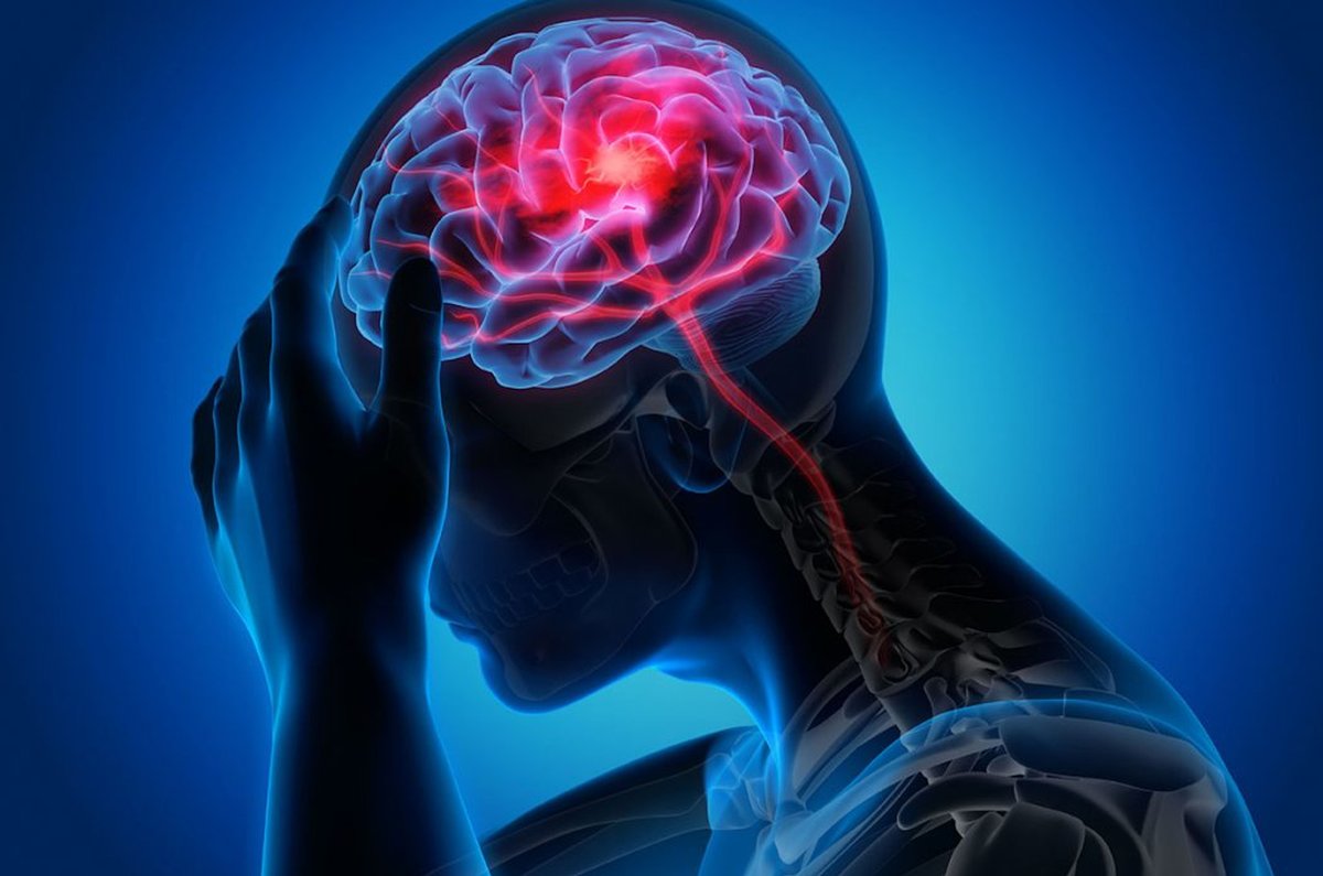 BaptistHealthSF's tweet photo. Experts at Baptist Health Miami Neuroscience Institute are part of #ComprehensiveStrokeCenter always at the ready with most advanced treatments. Learn more from Italo Linfante, M.D., medical director, Interventional Neuroradiology. #StrokeAwareness https://t.co/1XWnD71dSW https://t.co/7epWPP1ZOA