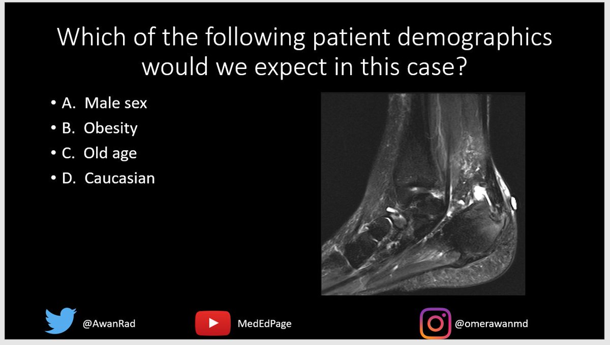 MSK CASE #84- Watch and Learn!  youtube.com/watch?v=hIZrq0….  #MedEd #MedTwitter <a href="/skeletalrad/">Angel Gómez-Cintrón, MD, MPH</a> <a href="/mahad_minhas/">M&M, MD, MPH</a> <a href="/_the_SRT/">The Society of Radiologists in Training</a> <a href="/VivekKaliaMD/">Vivek Kalia, MD MPH</a> <a href="/Vilavaite/">María J. Díaz Candamio</a> @jennybencardino <a href="/MskSerme/">SERME</a> <a href="/northwoods1980/">RJ</a> <a href="/dflemosmd/">Diego Lemos</a> <a href="/AminaFarooqMD/">Amina Farooq</a> <a href="/koolkpMD/">Kirang Patel, MD</a> <a href="/ACRRFS/">ACR RFS - We've Moved! Follow @RadiologyACR.</a> <a href="/theAPDR/">The APDR</a> <a href="/alihusnain186/">Ali Husnain, MD</a> <a href="/alineserfaty/">Aline Serfaty</a>