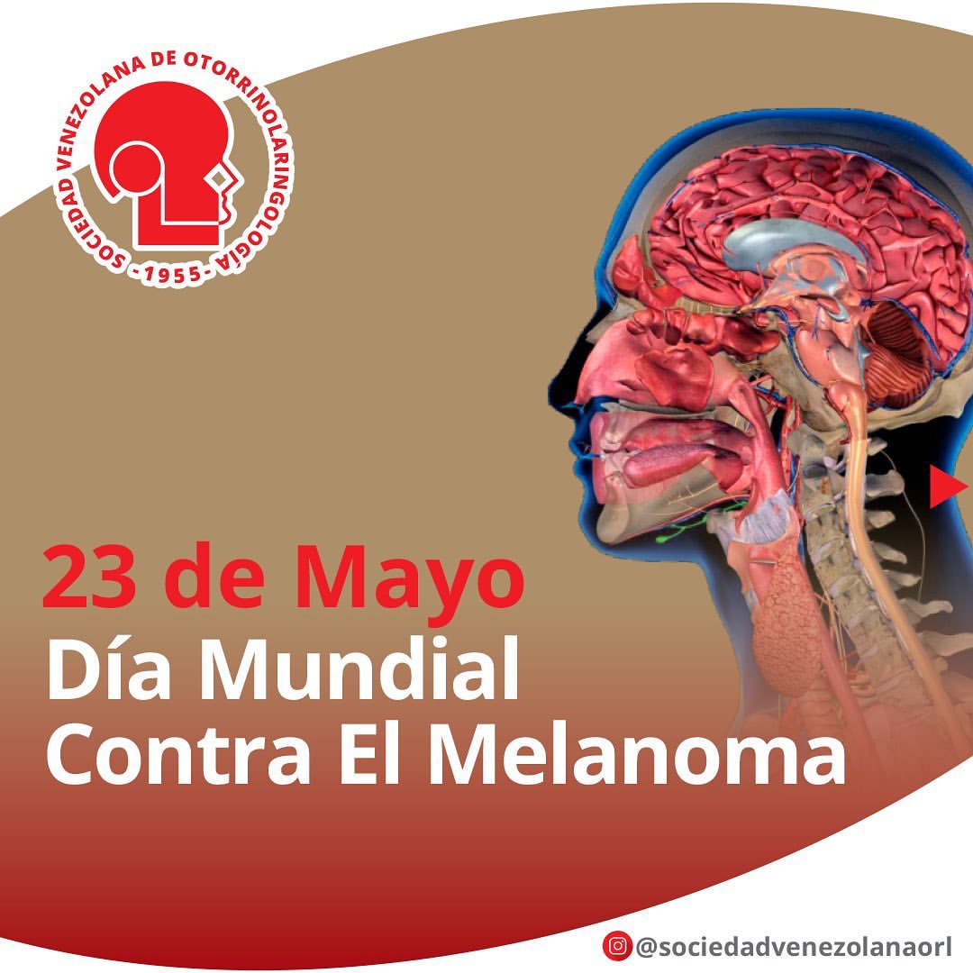 svorl's tweet photo. Día mundial del melanoma,acude al otorrino ante cualquier lesión en cabeza y cuello #SVORL #DiaMundialDelMelanoma https://t.co/mzp6ut5PoN