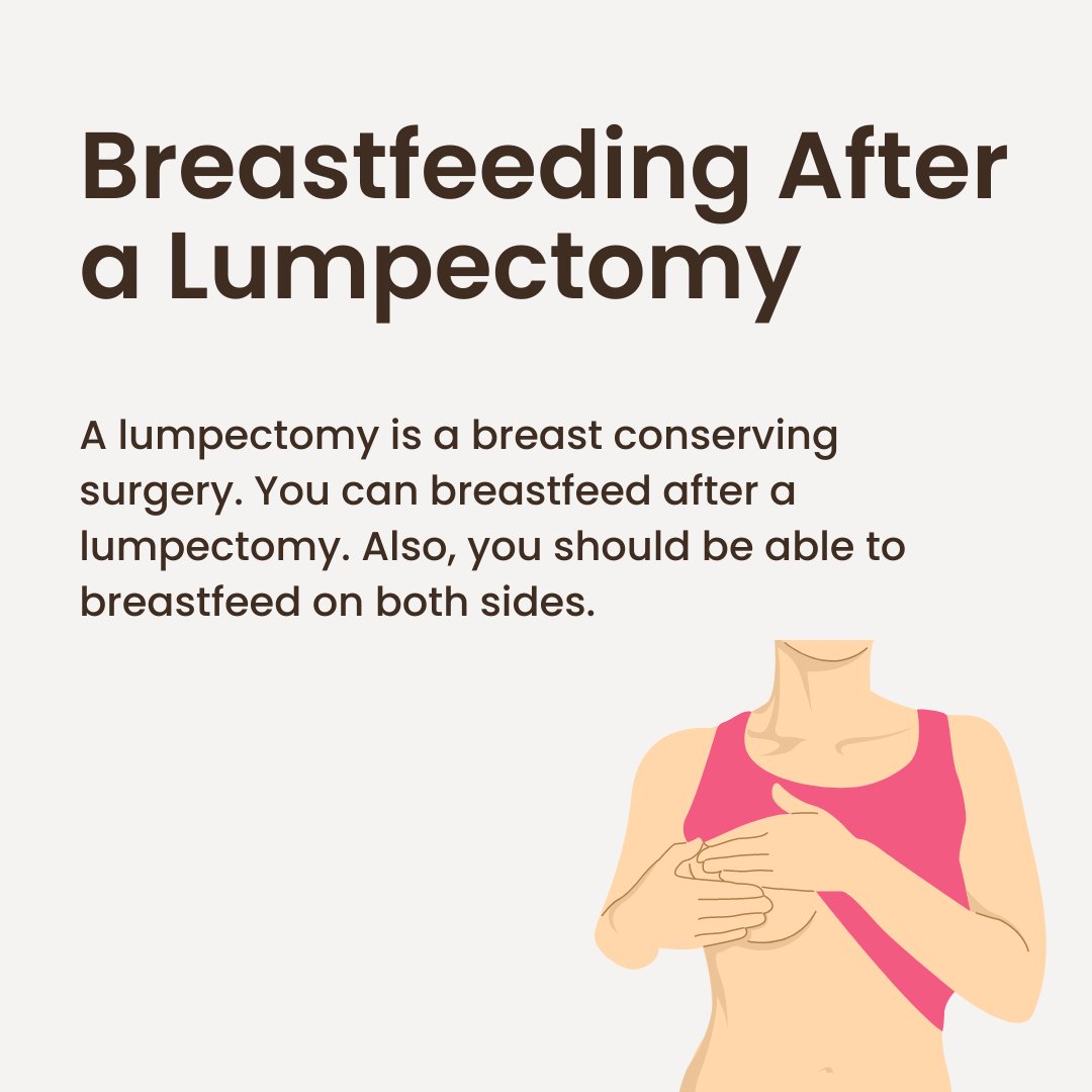yerbba_bc's tweet photo. Learn more about whether or not breastfeeding is an option during breast cancer and its treatment. 
#breastcancer #breastcancersupport #cancersupport https://t.co/bGiZylzlor