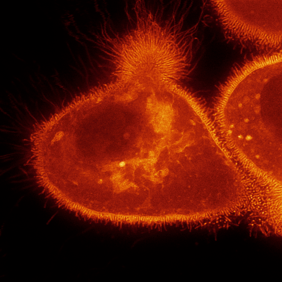 MarcCGoudge's tweet photo. This Thursday (5/25) @ 9:00 AM EST, I'll be defending my PhD! If you want to learn about how  Muc1 can regulate intracellular membrane morphologies and more, all are welcome! The event will be hybrid, so please DM if interested. Some fun highlights that didn't make the talk: https://t.co/gvdufqrdsh