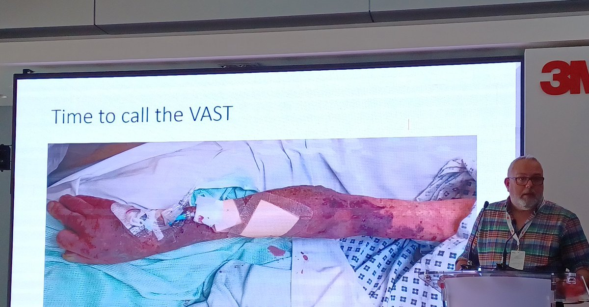 VictoriaArmen14's tweet photo. ¿Cuanto más vas a esperar para llamar al equipo de acceso vascular? @IV_Nurse cómo siempre genial #3MIVSUMMIT #segpaciente https://t.co/MtxKzknTm1