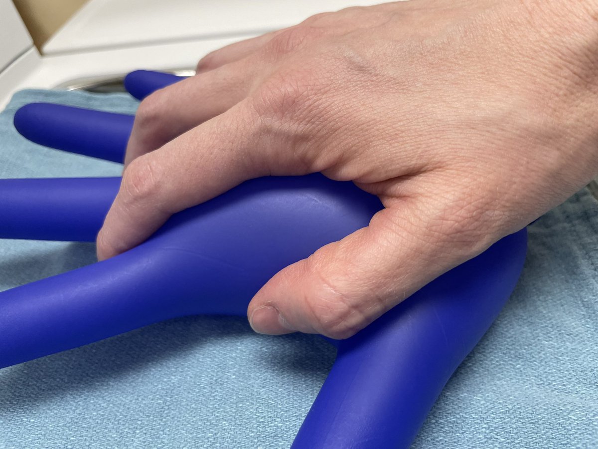 Gas_Air_CCdoc's tweet photo. #anaesthetic tip for doing long prone cases with arms flexed 90 degrees: Utilise the happy glove 🧤 hands to prevent pressure on the wrist and fingers from lying on the arm boards. Cheap and effective and also fun to do. https://t.co/NBEMwNjU68