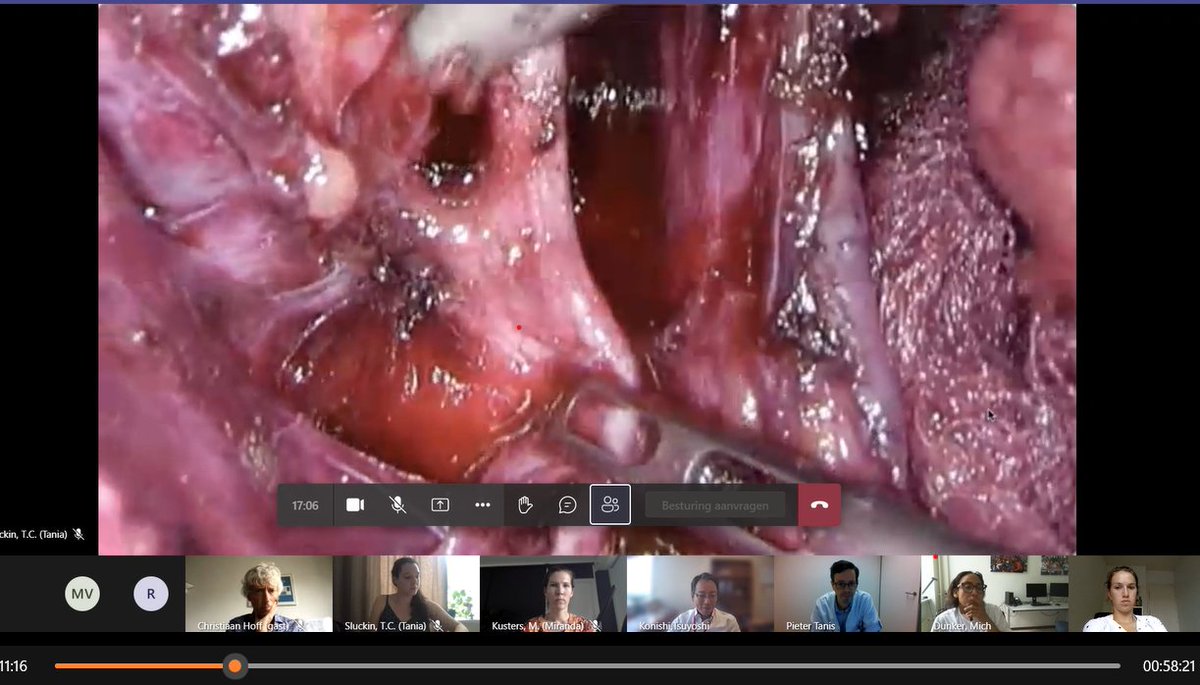 Since the hands-on cadaver session in 2021, monthly proctoring sessions have been implemented to provide feedback and guarantee uniform dissection. Last months the do’s and don’ts of LLND surgery were discussed. #colorectalsurgery #LLND #improvement